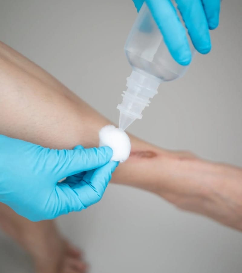 Doctor applying wound dressing to patient